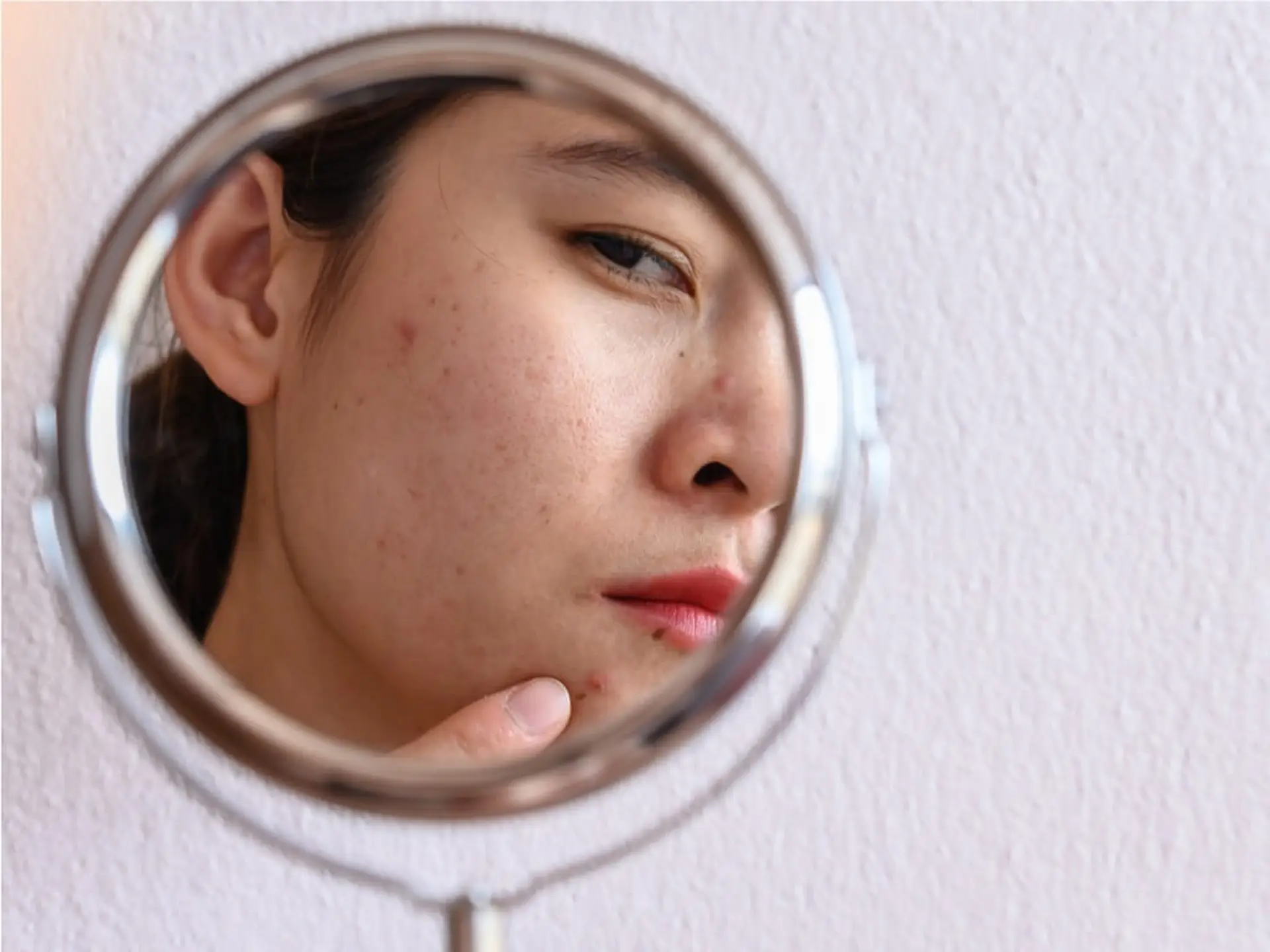 woman looking at acne on her face