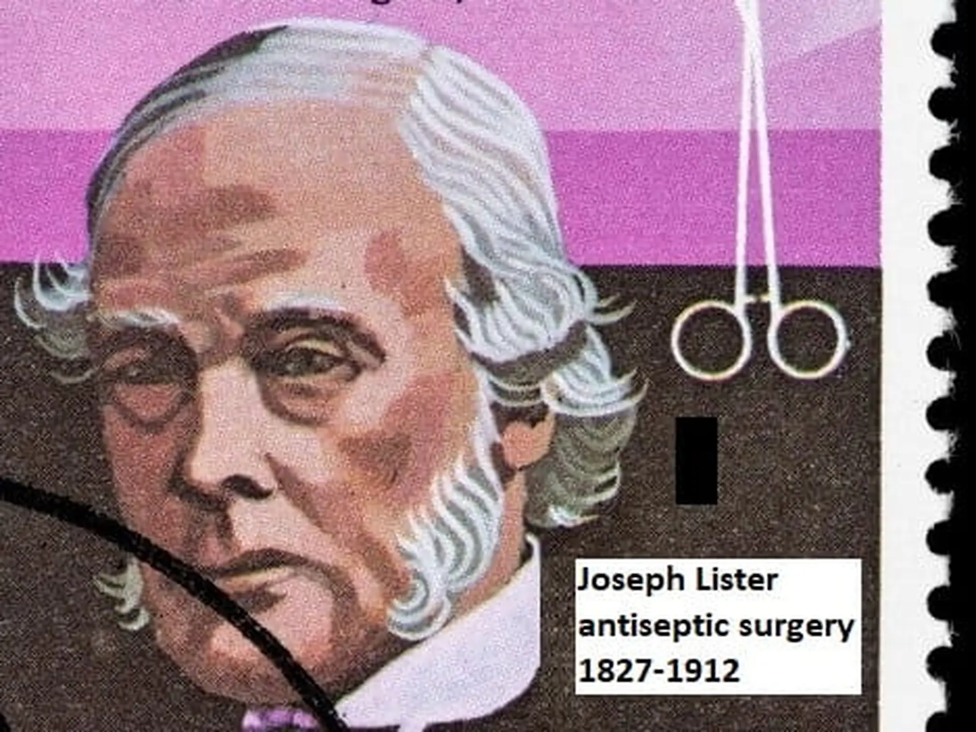 chlorhexidine joseph lister
